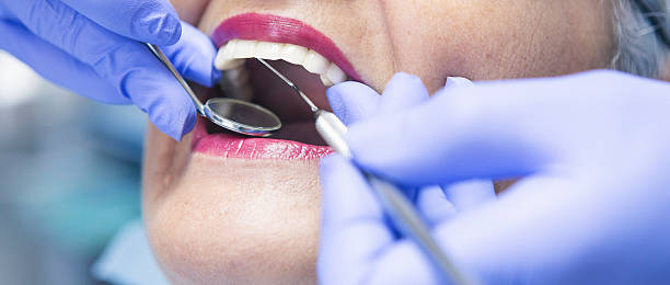 Best Chipped Tooth Repair Near Me  in Poulsbo, WA